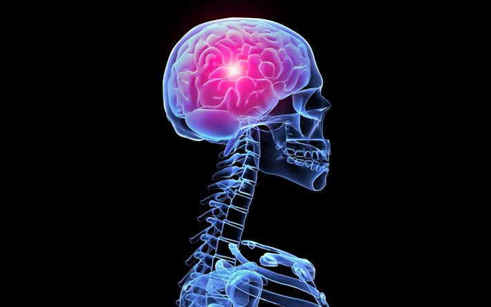 brain, x-ray, headache concepts, ridge x-ray, black background, brain concepts