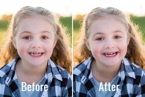 a girl with teeth before and after photoshop funny wallpaper