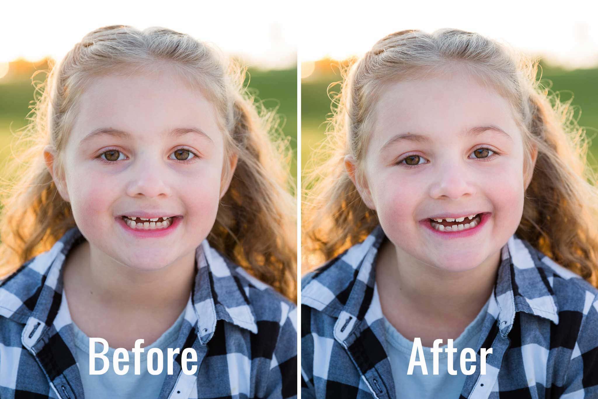 a girl with teeth before and after photoshop — 2048x1365 wallpaper